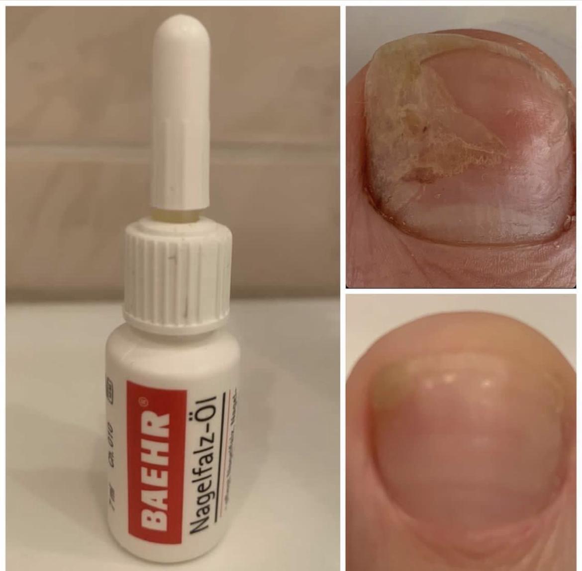 BAEHR regenerating oil with wheat germ (NAGELFALZ-ÖL), 7 ml